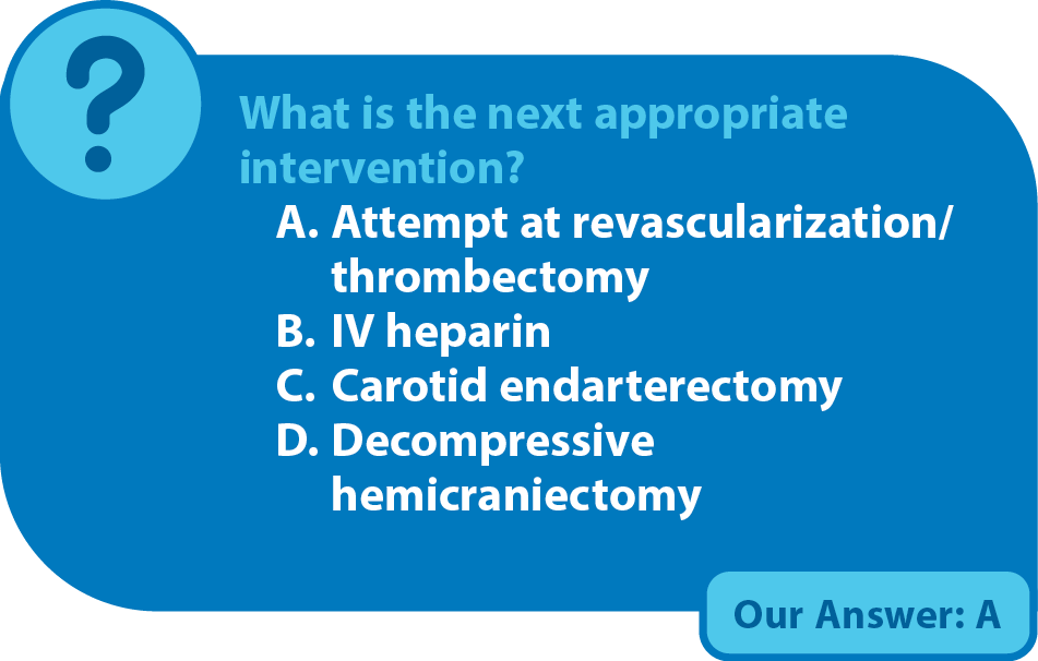 Acute Ischemic Stroke With Tandem Occlusion Requiring Cervical And ...